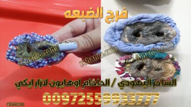 فرج الضبعه